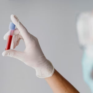 What Is the Ideal White Blood Cell Count?